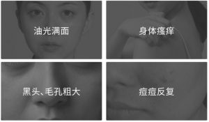 螨虫脸的四大症状，除螨大作战