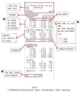医院视力验光单该怎么看？详细为你解读视力检查单