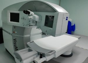 怎样判断哪种类型的近视手术适合自己? 盘点近视手术类型